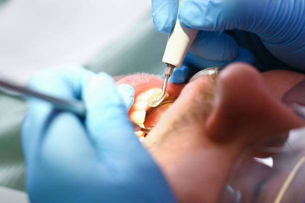 Best Dental Abscess Treatment in Lford, MI