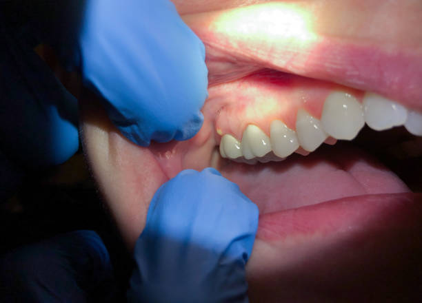 Best 24-Hour Emergency Dental Care in Lford, MI