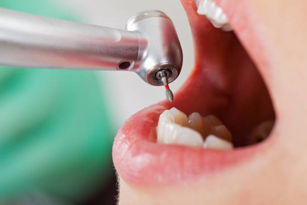Best Emergency Care for Gum Disease in Lford, MI